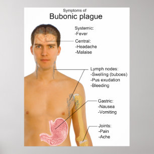 Poster Symptômes principaux de diagramme de peste