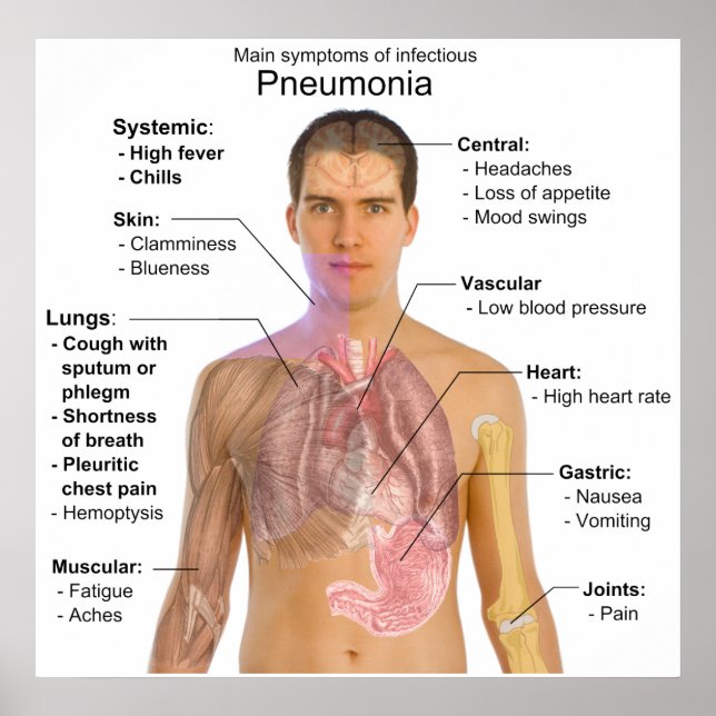 Poster Symptômes principaux du diagramme de pneumonie inf (Devant)
