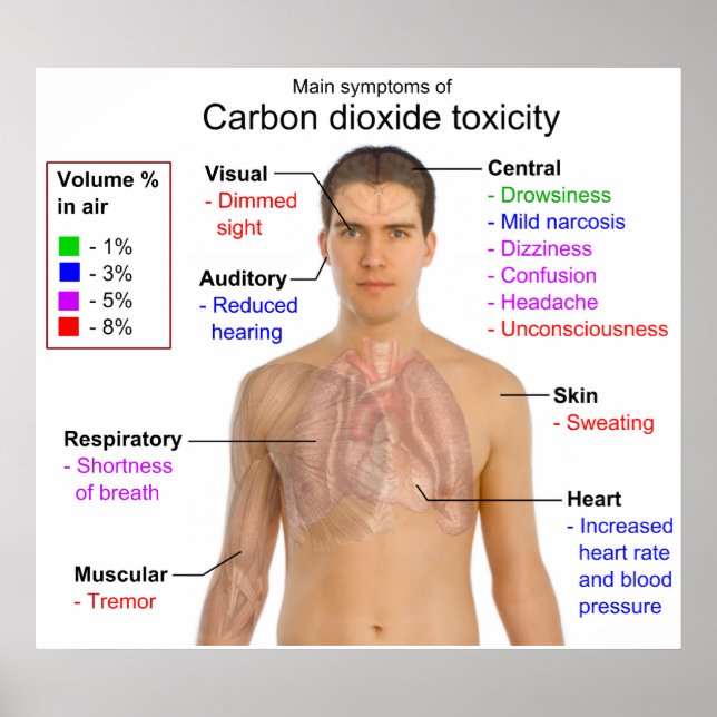 Poster Symptômes principaux du diagramme de toxicité du d (Devant)