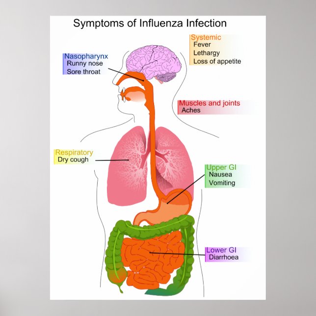 Poster Symptômes principaux d'un diagramme d'infection gr (Devant)