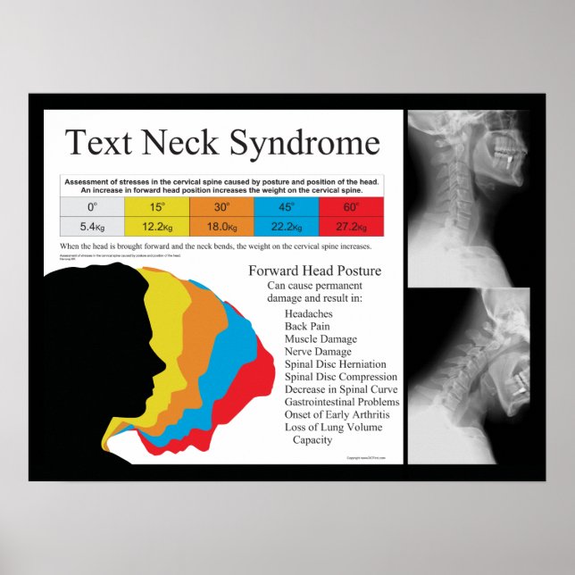 Poster Syndrome du cou du texte Chiropratique en kg métri (Devant)