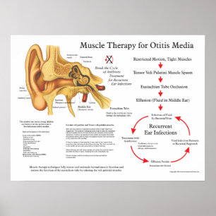 Poster Thérapie de massage musculaire pour l'otite