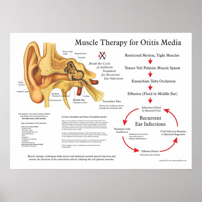 Poster Thérapie de massage musculaire pour l'otite (Devant)