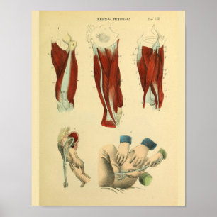 Poster Thigh Muscles Birth Forceps Anatomy Art Print