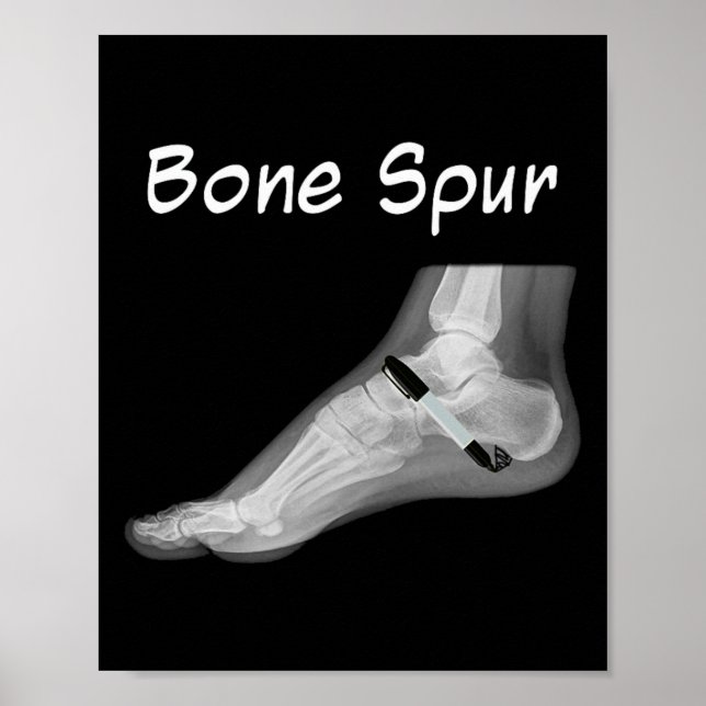 Poster Trump Bone Spur Ink Pen Funny Anti Trump  (Devant)