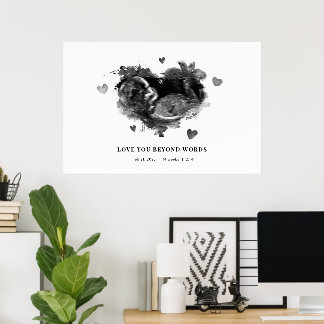 Poster Ultrasons de grossesse bientôt Faire-part