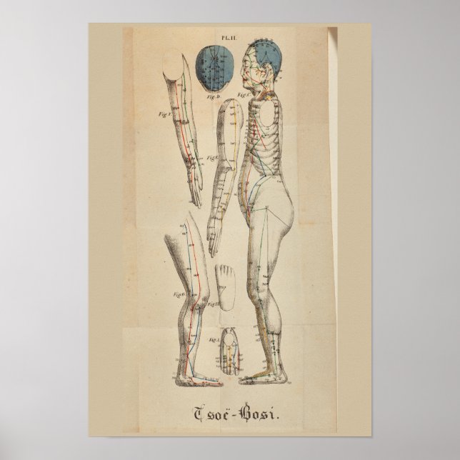 Poster Vintage Français 1825 Acupuncture Méridien Points (Devant)