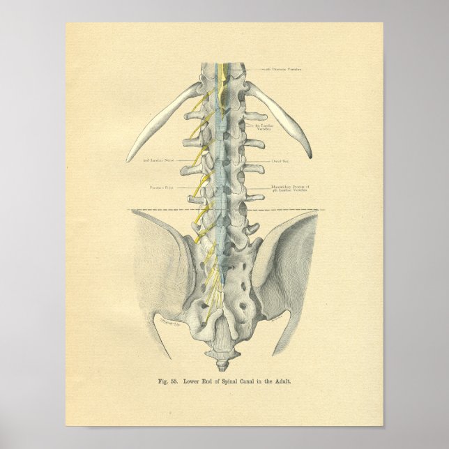 Poster Vintage Frohse Anatomique Lumbar Spine (Devant)
