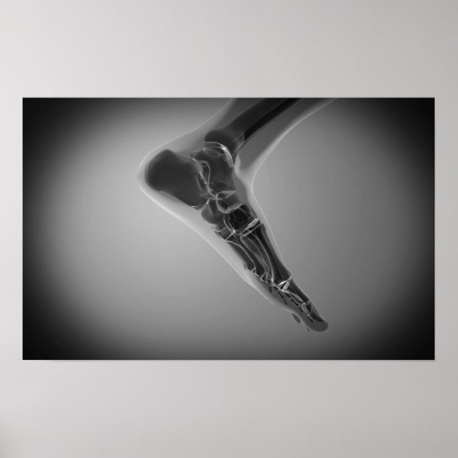 Poster Vue En Rayon X Du Pied Humain 4 (Devant)