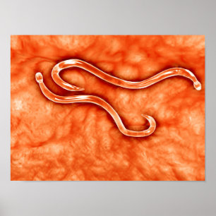 Poster Vue Microscopique De Hookworm 2