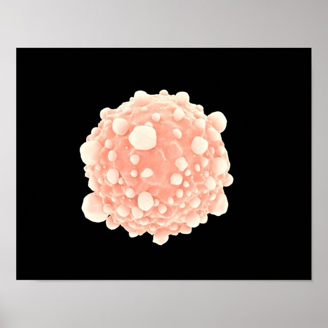 Poster Vue Microscopique De La Cellule Cancer Pancréatiqu (Devant)