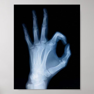 POSTER X-RAY A-OK
