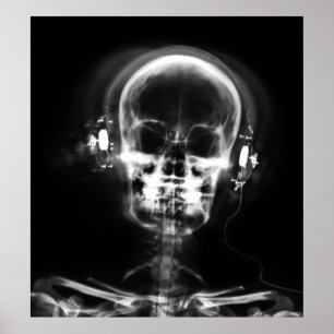 POSTER- X-RAY MUSIC SKELETON BLACK GRAY B&W POSTER