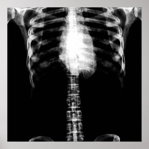 POSTER X-RAY SKELETON TORSO RIBS - B&W