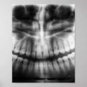 Poster X-Ray Teeth Bouche sourire noir et blanc