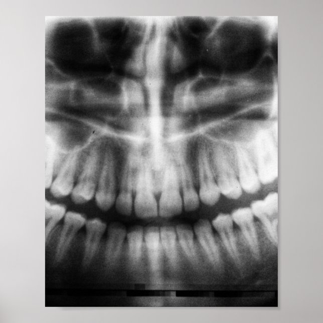 Poster X-Ray Teeth Bouche sourire noir et blanc (Devant)