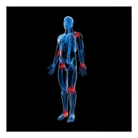 Xray humain
