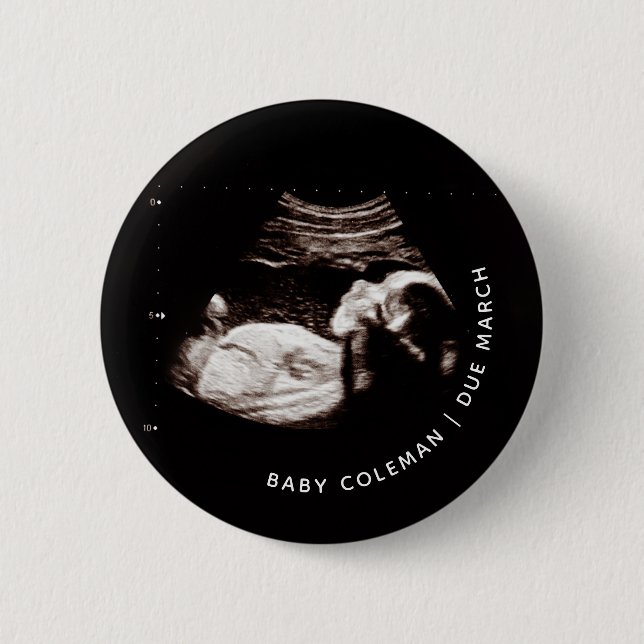Pregnancy Announcement Baby Sonogram Photo Button (Vorderseite)