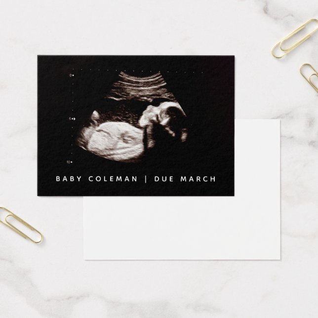 Pregnancy Announcement Sonogram Mini Card Pack (Büro)