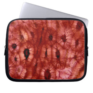 Protection Pour Ordinateur Portable Cellules de Sclerenchyma d'un puits de cerise
