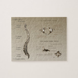 Puzzle Épine