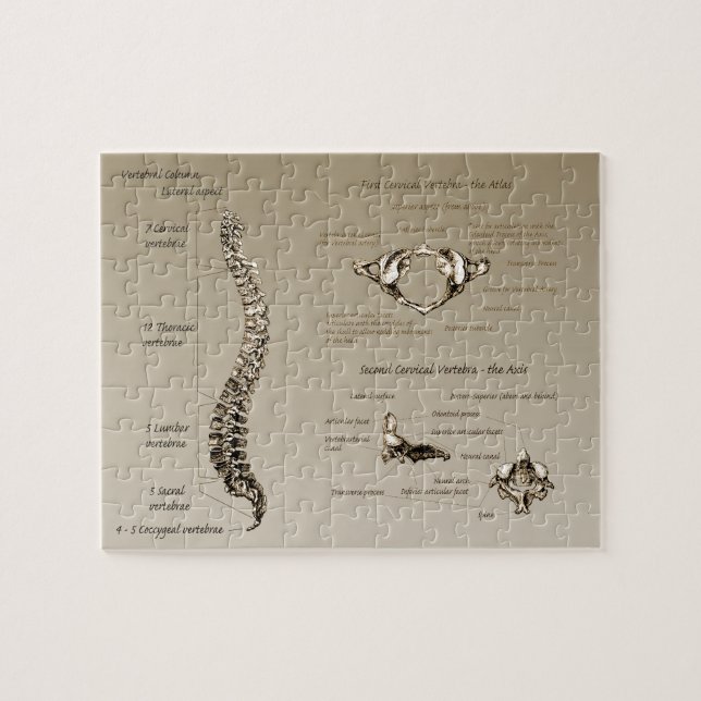 Puzzle Épine (Horizontal)