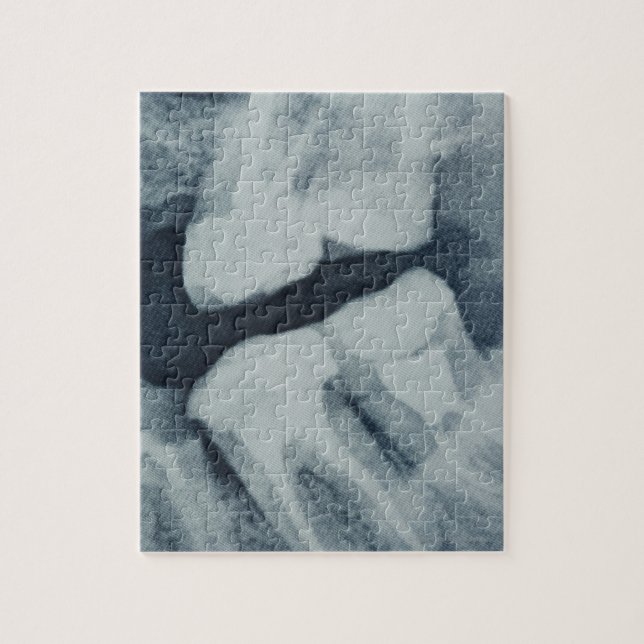 Puzzle Gros plan d'une radiographie dentaire (Vertical)