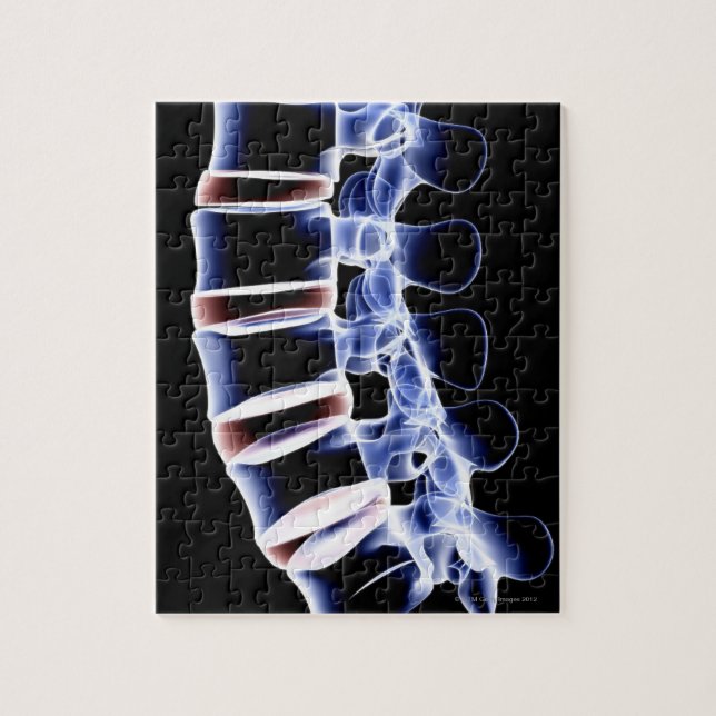 Puzzle Lumbar Vertebrae 2 (Vertical)