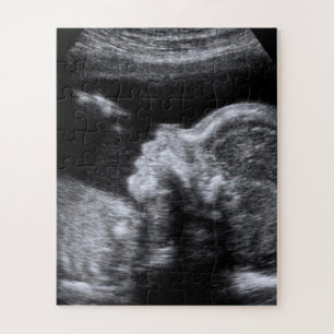 Puzzle Photo Ultrasound