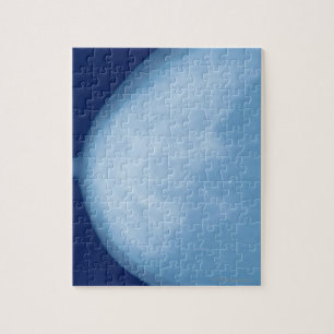 Puzzle Rayon X du sein féminin, vue latérale