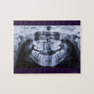 Puzzle Xray d'une mâchoire fillette prise avec le panoram