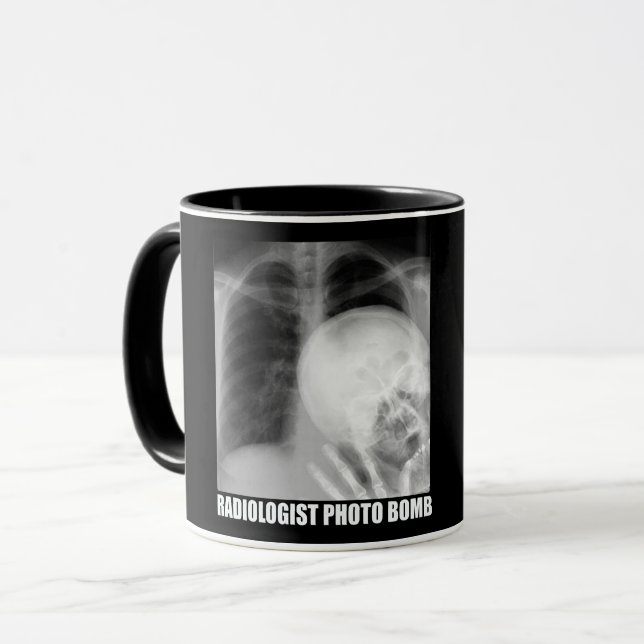 RADIOLOGISTISCHES FOTO BOMB TASSE (Vorderseite Links)