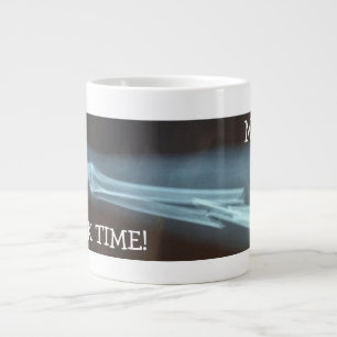 Radius und Ulna Xray "Break Time" Jumbo-Tasse