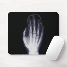 Ray Skeleton Hand Xray