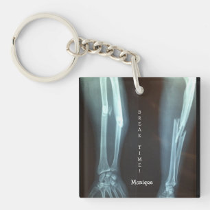 Rayon cassé et Ulna Xray "Temps de pause"  