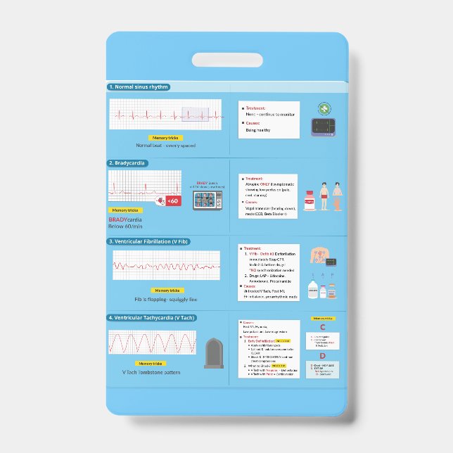 Référence rapide du badge EKG (Face)