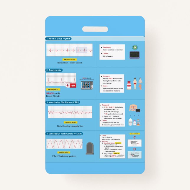 Référence rapide du badge EKG (Devant)