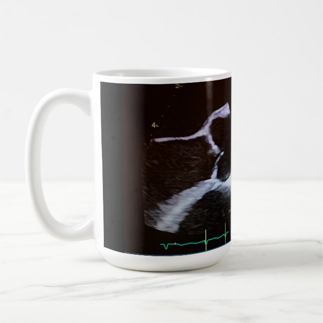 Robinet aortique doppler echocardiogramme tasse (Gauche)