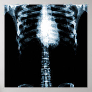 RÖHRSKELETON TORSO RIBS - BLAU POSTER