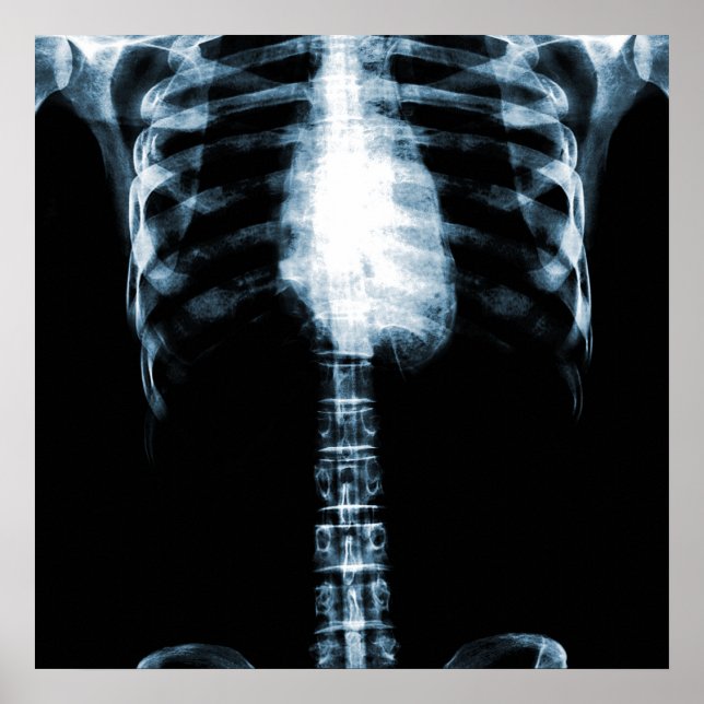 RÖHRSKELETON TORSO RIBS - BLAU POSTER (Vorne)
