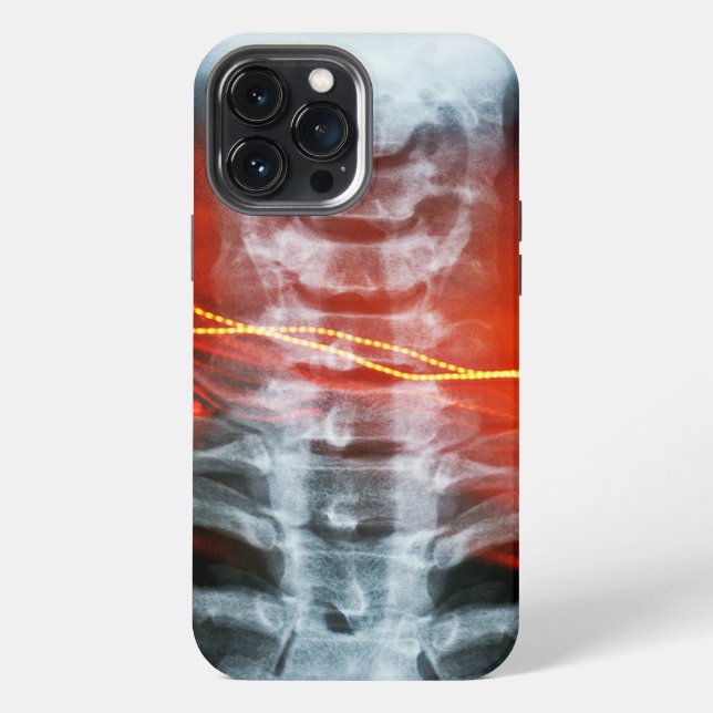 Röntgen-Digitalkunst-Handyhülle iPhone Hülle (Rückseite)