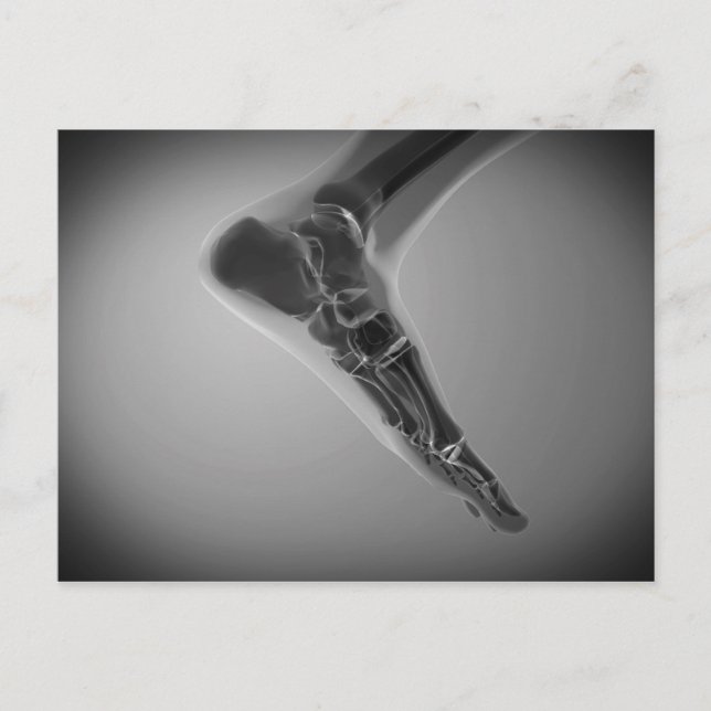 Röntgenaufnahme des menschlichen Fußes 4 Postkarte (Vorderseite)