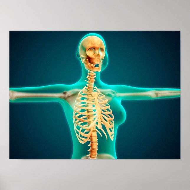 Röntgenaufnahme des weiblichen Oberkörpers mit Rip Poster (Vorne)