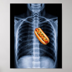Röntgenbild Brustkorb Hot Dog Herz Lustige Nahrung Poster