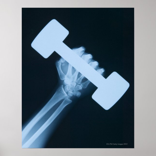 Röntgenbild der menschlichen Hand mit Gewicht, nah Poster (Vorne)