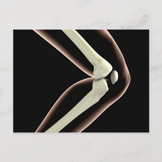 Röntgenbild des Knies 1 Postkarte (Vorderseite)