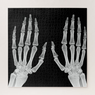 Röntgenbild Skeletthände menschliche Anatomie Foto