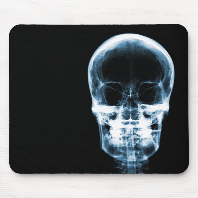 RÖNTGENBLICK-SKELETON SCHÄDEL - Blau Mousepad (Vorne)