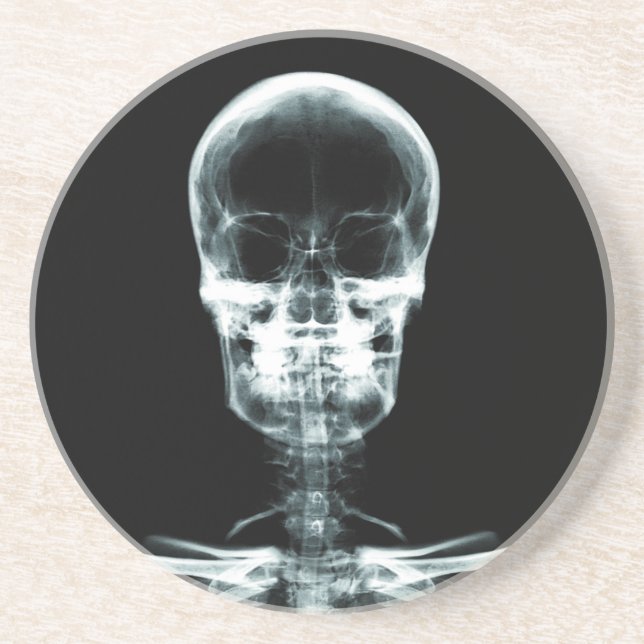 RÖNTGENBLICK-SKELETON SCHÄDEL - VORLAGE SANDSTEIN UNTERSETZER (Vorne)