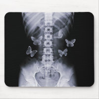 Röntgenstrahl-Begriffsschmetterlinge Mousepad